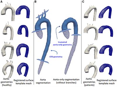 WSSNet: Aortic Wall Shear Stress Estimation Using Deep Learning on 4D Flow MRI